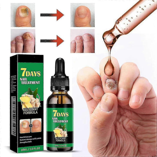JAYSUING - 7 DAYS Tratamiento para Hongos en Uñas – Pies y Manos (30 ml)
