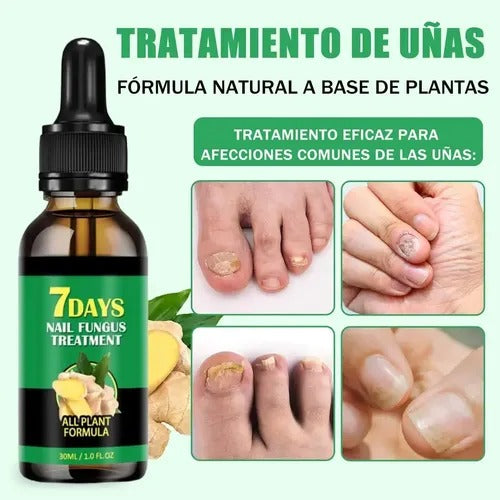 JAYSUING - 7 DAYS Tratamiento para Hongos en Uñas – Pies y Manos (30 ml)