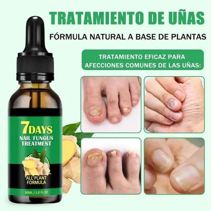 JAYSUING - 7 DAYS Tratamiento para Hongos en Uñas – Pies y Manos (30 ml)